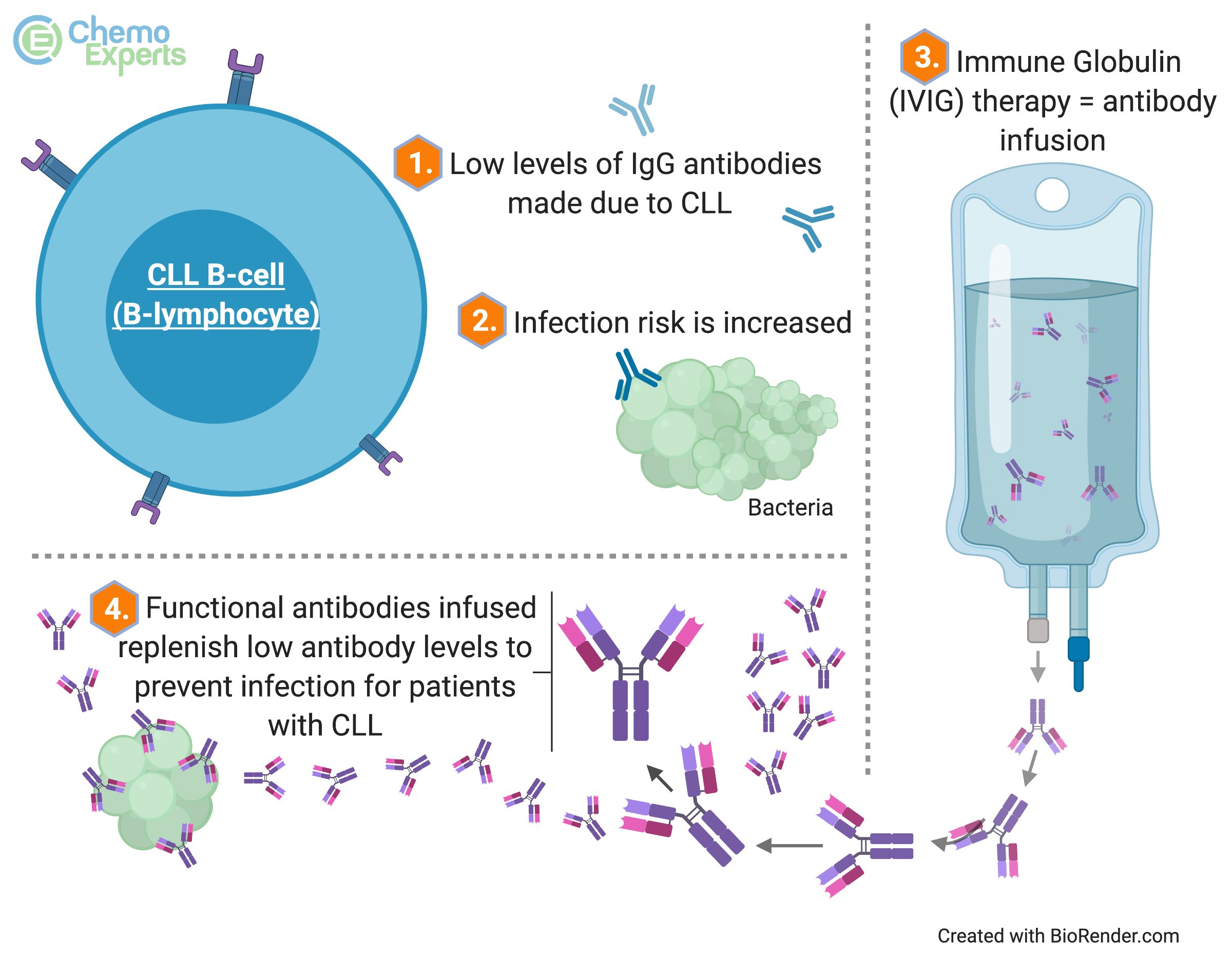 Image showing how IVIG may prevent severe infections in patients with CLL and hypogammaglobulinemia